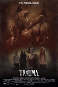 Травма